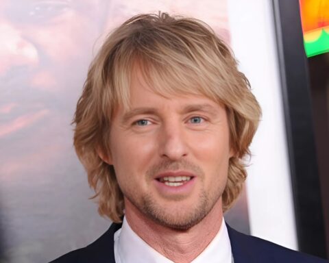 Owen Wilson Nase